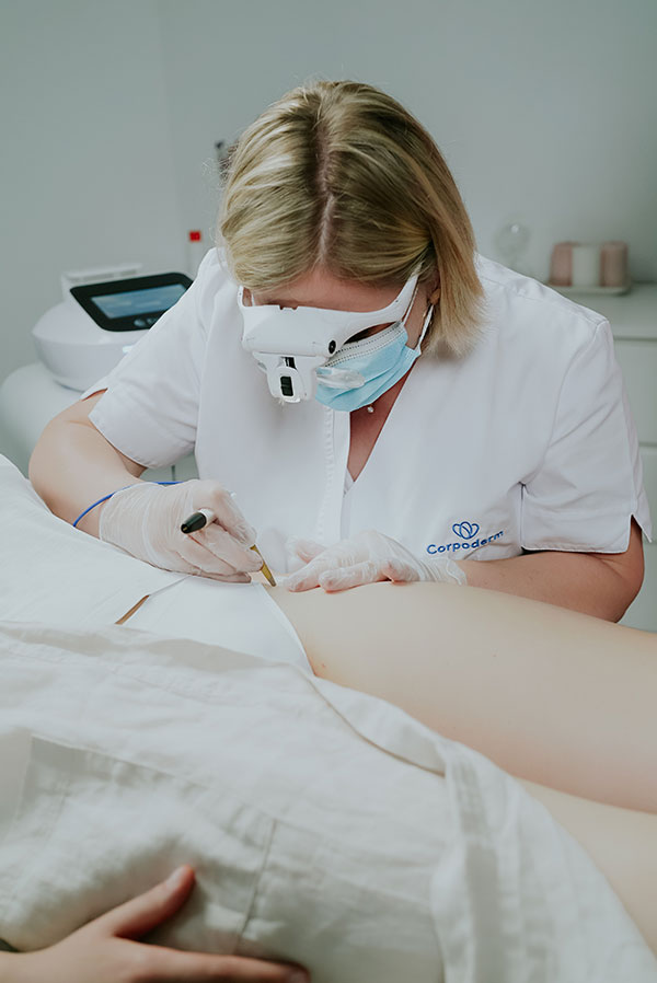 séance d'épilation thermolyse du maillot