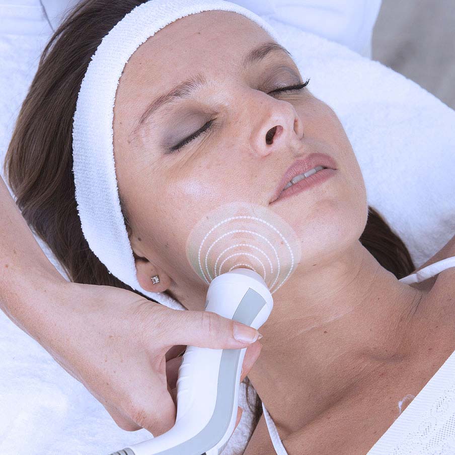 application radiofréquence visage