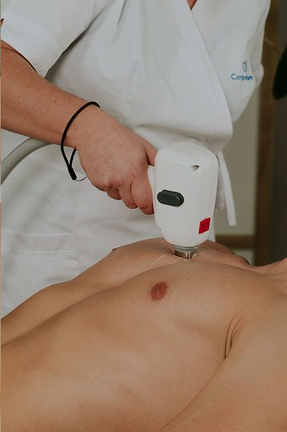 épilation laser du torse