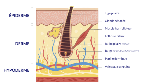 illustration du procédé de photo-thermolyse sélective pour l'épilation définitive