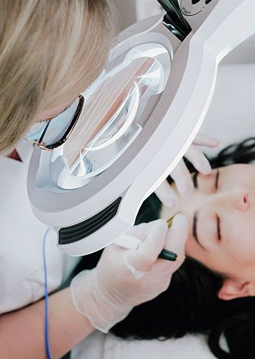 épilation électrique visage